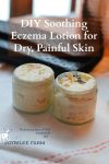 Jars of homemade eczema cream